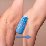 Vaëliz — Sérum Antivellos Encarnados™